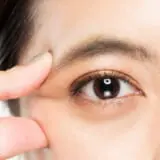 【まぶたがしわしわ】になる4つの原因。自力で目立たなくする方法はある?医師監修