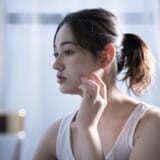 ニキビに悩む女性