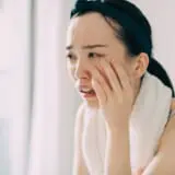 肌荒れ レチノール a反応