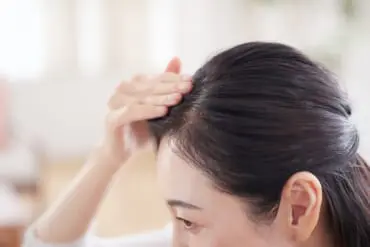 生え際